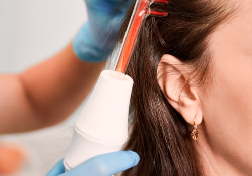 Unlock Your Hair Potential: Laser Hair Restoration And Hairstyling In Westlake Village